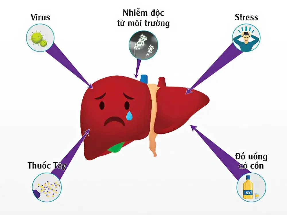 Hỗ trợ điều trị bệnh gan bằng củ ngải đen 2 Vì sao cần thanh lọc gan?